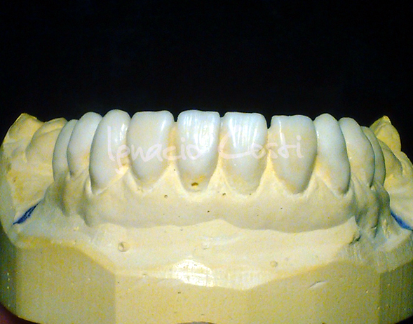 Encerado diagnóstico de 35 a 45 · Encerado · Laboratorio Ignacio Costi Madrid